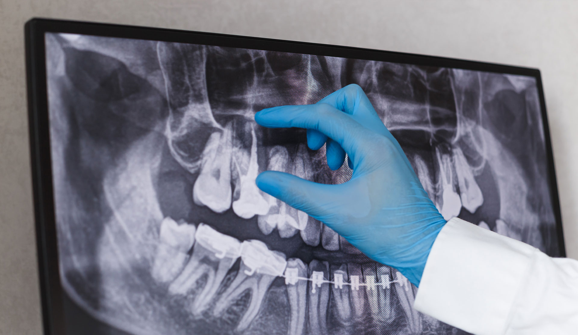 Brian C. Vinson, DMD Family Dentistry | Dental Bridges, Night Guards and Oral Cancer Screening