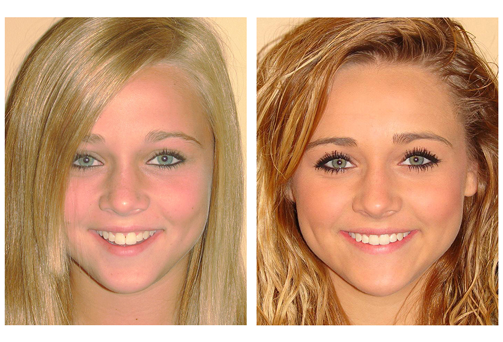 Brian C. Vinson, DMD Family Dentistry