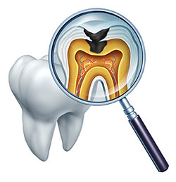 Brian C. Vinson, DMD Family Dentistry | Implant Dentistry, Cosmetic Dentistry and CBCT