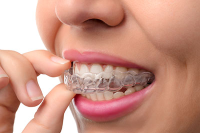 Brian C. Vinson, DMD Family Dentistry | Oral Exams, Teeth Whitening and Emergency Treatment
