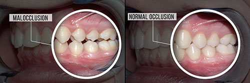 Brian C. Vinson, DMD Family Dentistry | Crowns, Implant Dentistry and CBCT