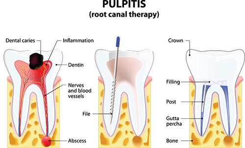 Brian C. Vinson, DMD Family Dentistry | Digital Radiography, All-on-4 reg  and CEREC