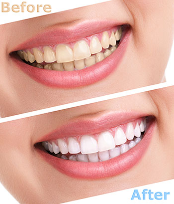 Brian C. Vinson, DMD Family Dentistry | Full Mouth Reconstruction, CBCT and Digital Radiography
