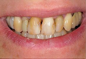 Brian C. Vinson, DMD Family Dentistry | Oral Exams, Intraoral Camera and Sedation Dentistry